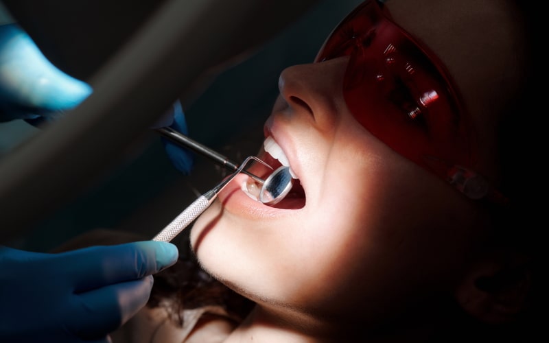 Why preventative dentistry is a must?